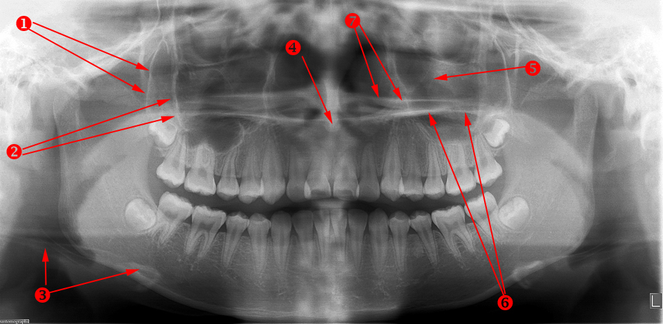 Oral Radiology U Of Mn